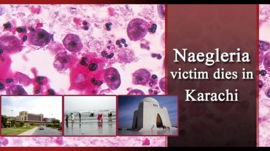 Naegleria brain eating amoeba is back in karachi
